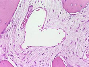 Radiologue Mammographie Nice Antibes Juan les Pins